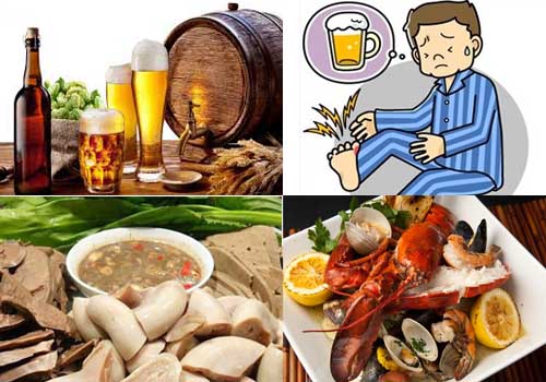 chế độ ăn uống và sinh hoạt là nguyên nhân chính của bệnh Gout (gút)